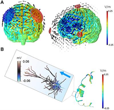 Transcranial current stimulation in epilepsy: A systematic review of the fundamental and clinical aspects